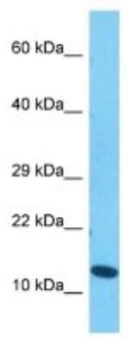 Histone 3 H2a Rabbit anti-Human, Polyclonal, Novus Biologicals 100 &mu;g | Buy Online | Novus Biologicals | Fisher Scientific